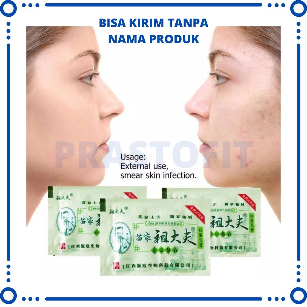 (SASET) ZUDAIFU SALEP GATAL ALERGI KULIT SELANGKANGAN EKSIM JAMUR OBAT HERBAL CINA PALING AMPUH