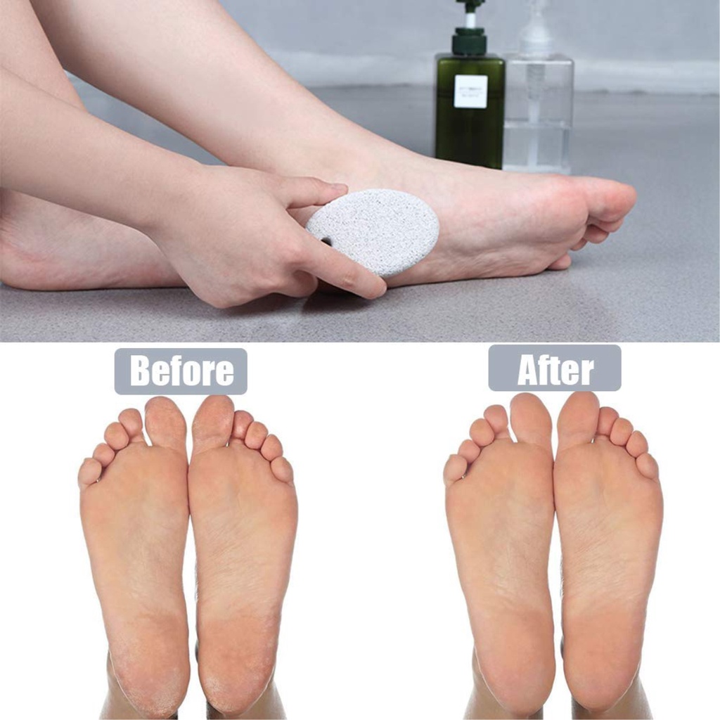 SHINE STAR - [ TERMURAH ] Sikat Kaki Batu Apung Pumice Stone Pembersih &amp; Penghilang KAPALAN Kaki Anda