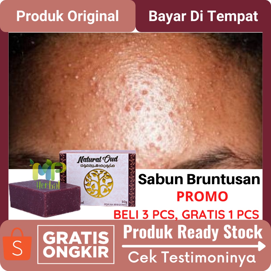 Jual Sabun Bruntusan Penghilang Bruntusan Di Wajah Penghilang Bruntusan Dan Bekas Jerawat