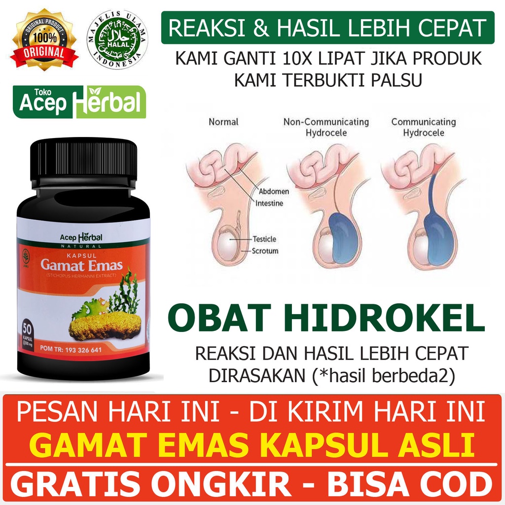 Obat Herbal Hidrokel Nyeri Kantung Buah Zakar Bengkak Pengempis Cairan Testis Buah Zakar Hidrocell V