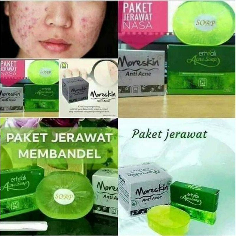 

PaketAcne/PaketJerawat
