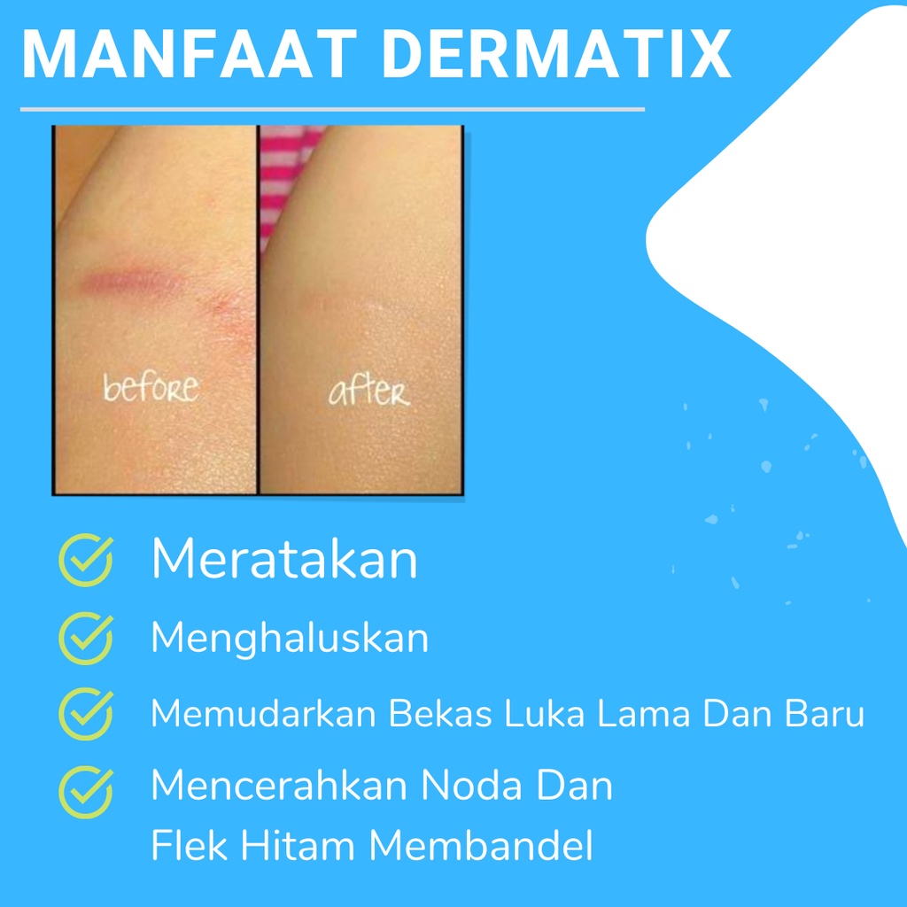 Dermatix Ultra Original - Salep Penghilang Bekas Luka di Wajah Strechmark Koreng Permanen 15g