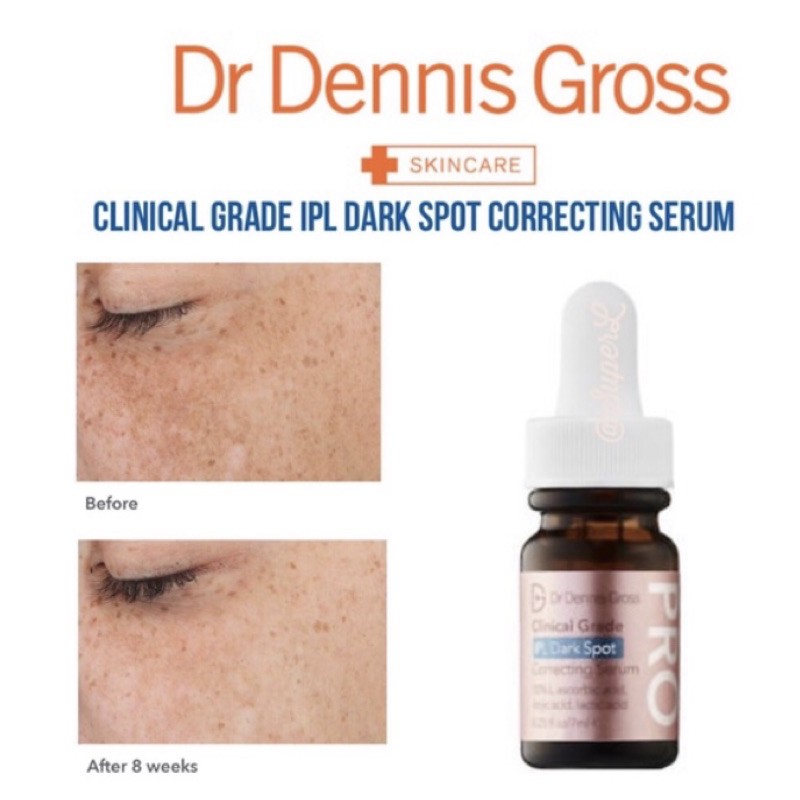 dr dennis gross dark spot serum