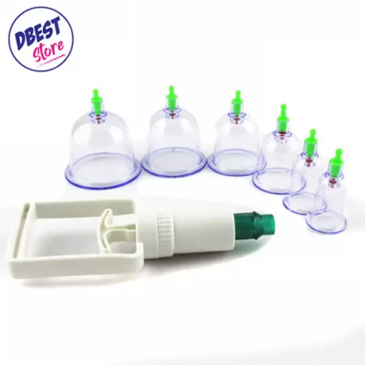 (BISA COD) Kop Angin / Alat Bekam Kesehatan Praktis Isi 6 Pcs Tabung