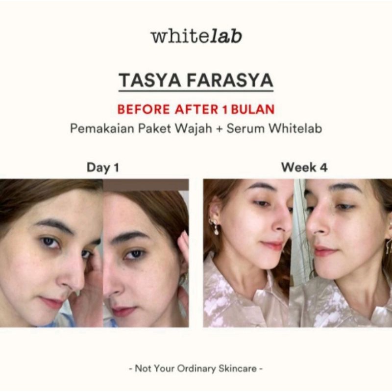 Whitelab Brightening Paket Wajah & Serum 100% ORI dan TERLARIS !!!-6