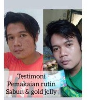 sabun kedas beauty, Pemutih Wajah, Badan ,Flek ,Ketiak ,Pria, Original-4