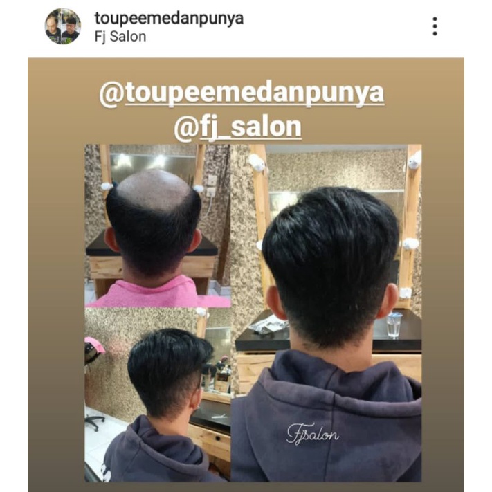 wig rambut asli,toupee, hairsystem penutup kebotakan