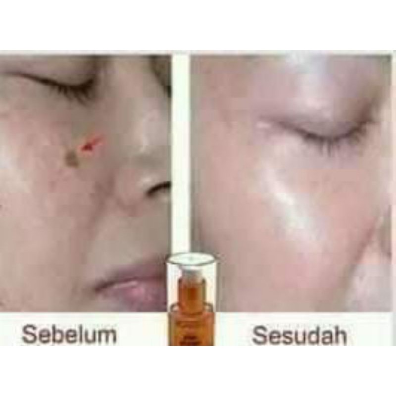 serum emas