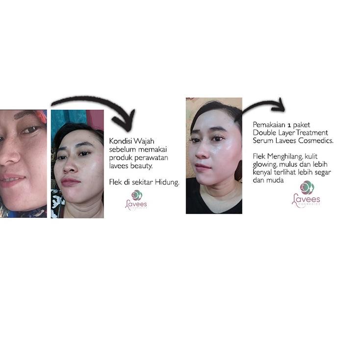 [ProdukINA] Lavees Cosmedics - Concentrate Glowhite Serum Essence [Serum Flek & Melasma] Bermutu