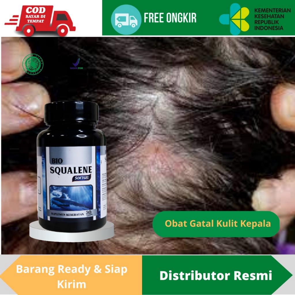 Obat Gatal Kulit Kepala, Obat Herbal Gatal Kulit Kepala, Obat Infeksi Jamur Kulit Kepala, Obat Alerg
