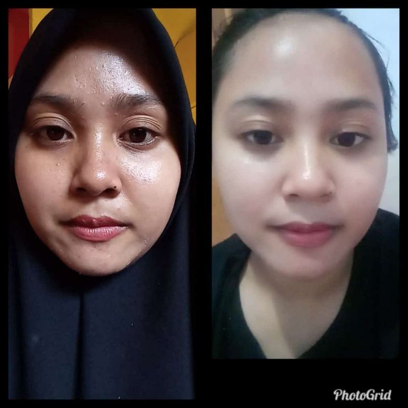 NR GLOW SKINCARE PAKET GLOW ll REMAJA BUMIL BUSUI DAN KULIT SENSITIF