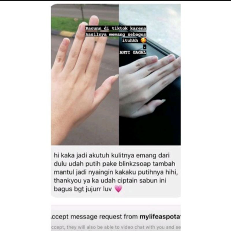 [COD] BLINKZ soap whitening VIRAL READY Stock