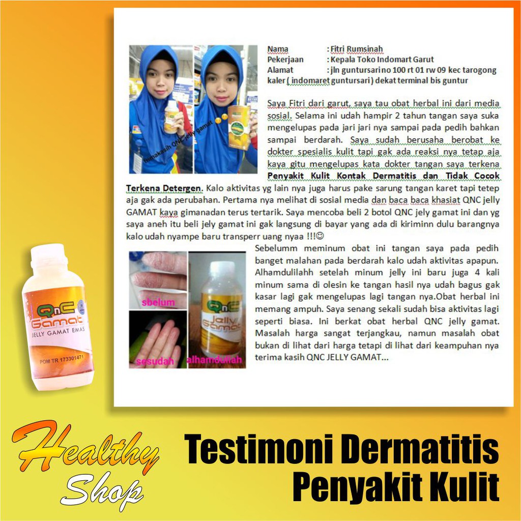 Penghilang Bekas Luka, Obat Jerawat, Eksim, Luka Bakar, Keloid, Gangren, Borok - QnC Jelly Gamat