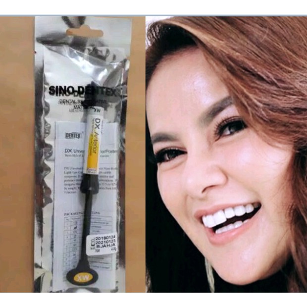 Composite Bahan Veneer Gigi Dentex warna EXW / EW, Extra White, SUPER PUTIH, Komposit Gigi Kelici