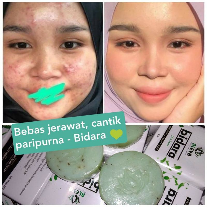 SABUN BIDARA ALEYA 100% ✔️ ORIGINAL PENCERAH PEMUTIH WAJAH DAN BADAN BPOM&HALAL