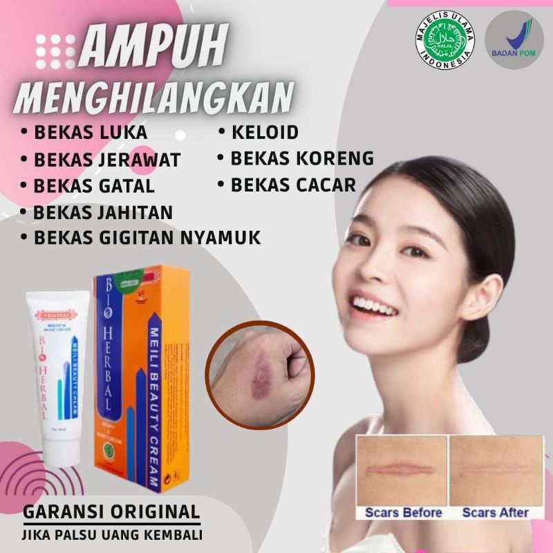 Salep Obat Cream Meilibahenling Penghilang Bekas Luka Lama Hitam Koreng Jerawat Bopeng Melibahenling