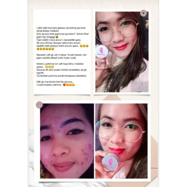 the ordinary water based moisturizer