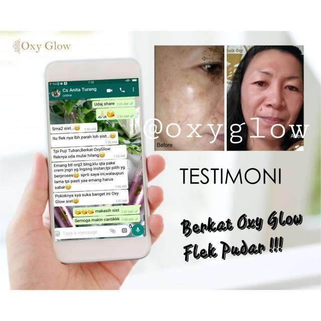 Paket Skincare Flek/Acne/Whitening OxyGlow Bonus Pouch Croco (Leather Bag)-7