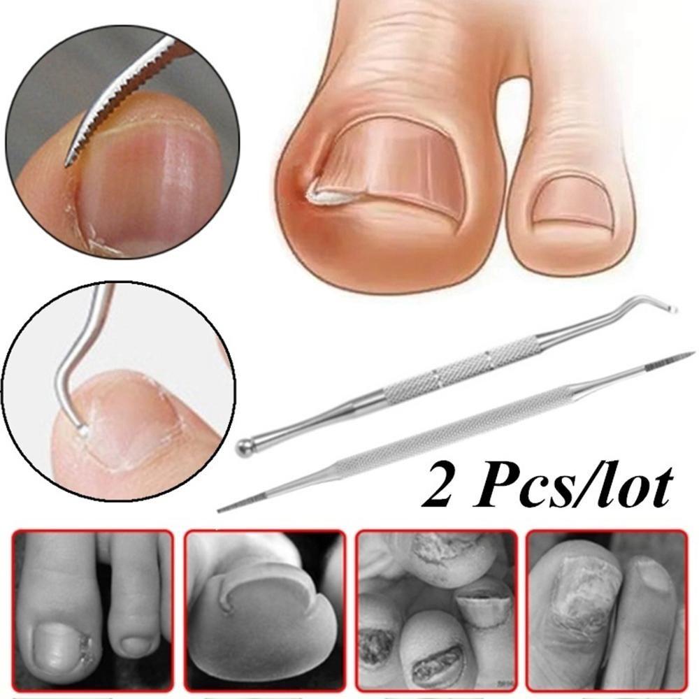 Preva 2Pcs/Set Kuku Kaki Ingrown Profesional Kutikula Pendorong Pembersih Kuku Paronychia