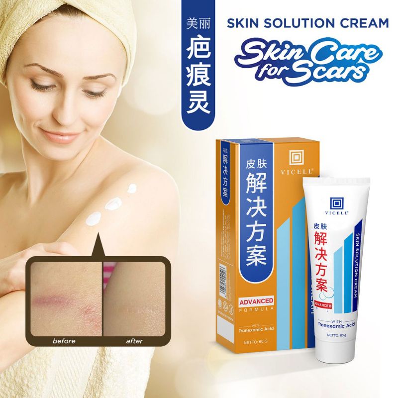 VICELL SKIN SOLUTION CREAM BPOM / PENGHILANG BEKAS LUKA ORIGINAL 60 GR/ KRIM MEILIBAHENLING / SAMARKAN CACAR JERAWAT HITAM KORENG KAKI TANGAN / BIO HERBAL / BIOHERBAL