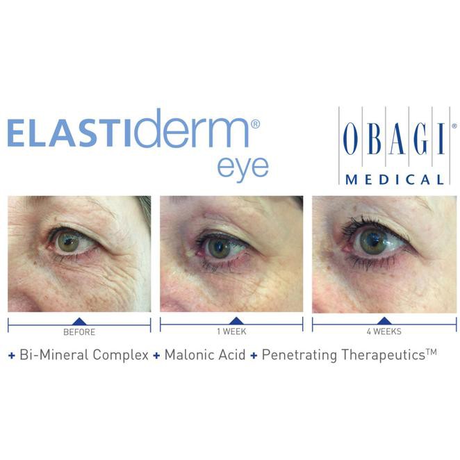 elastiderm eye cream