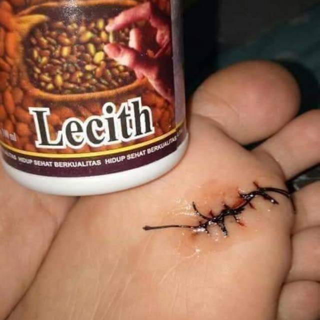 

Lecith