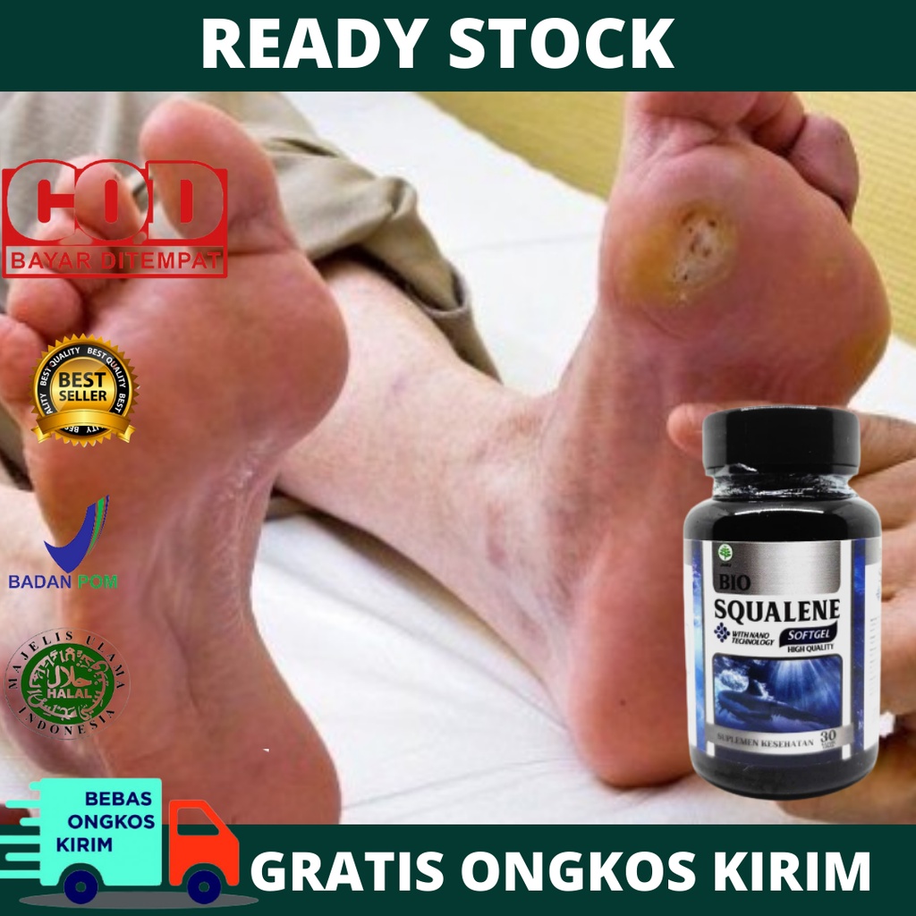 Obat Luka Infeksi Diabetes, Luka Diabet Basah, Kering, Penghilang Luka Diabetes Alami, Pengering Luk