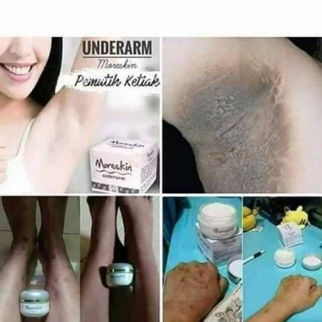 Moreskin underarm
