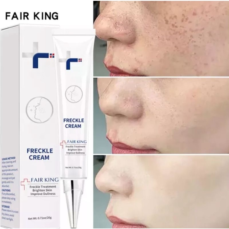 FAIR KING EFFECTIVE FRECKLE CREAM REMOVE DARK SPOT WHITENING CREAM FADE ACNE MELASMA-ANTI AGING SKIN LIGHTENING- CREAM PEMUTIH-KRIM PEMUTIH-WAJAH GLOWING KRIM-CREAM PENGHILANG FLEK-WAJAH CREAM SIANG MALAM-CREAM WAJAH GLOWING-20ml