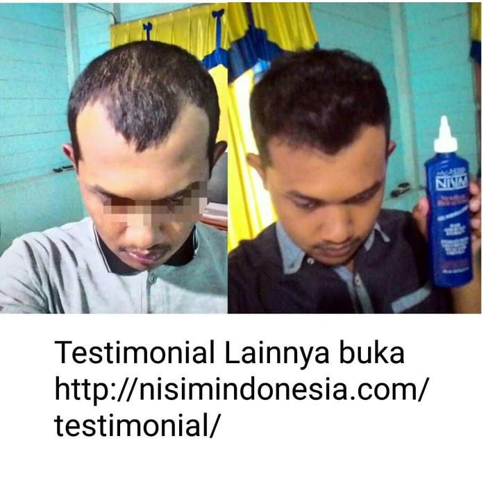 Paket Promo Biofactors Normal Minyak