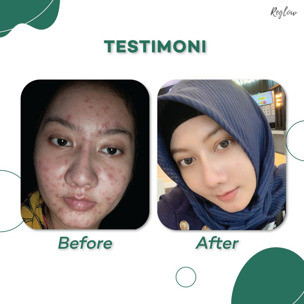 REGLOW Facial Wash Sabun Pembersih Wajah | Paket Perawatan Kecantikan Muka Glowing Glow | Atasi Jerawat Flek Hitam Milia Kusam | Skincare Skin Care BPOM Halal MUI | Sunscreen Whitening Anti-Aging | Aman Bumil Busui-6