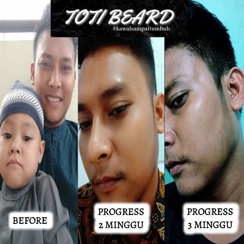 2in1;penumbuh &amp; penyubur bulu brewok (beard serum &amp; beard oil)#totibeard