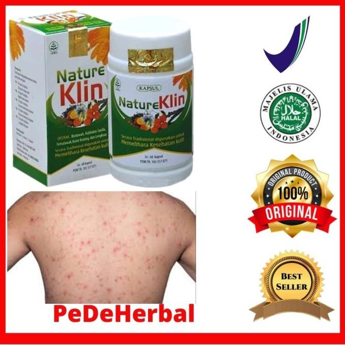 

Sale Herbal Kapsul Obat Gatal Gatel Kulit Kurap Jamur Kadas Eksim Bakteri /OBAT HERBAL ASAM URAT/OBAT HERBAL PELANGSING/OBAT HERBAL KOLESTEROL/OBAT HERBAL DIABETES