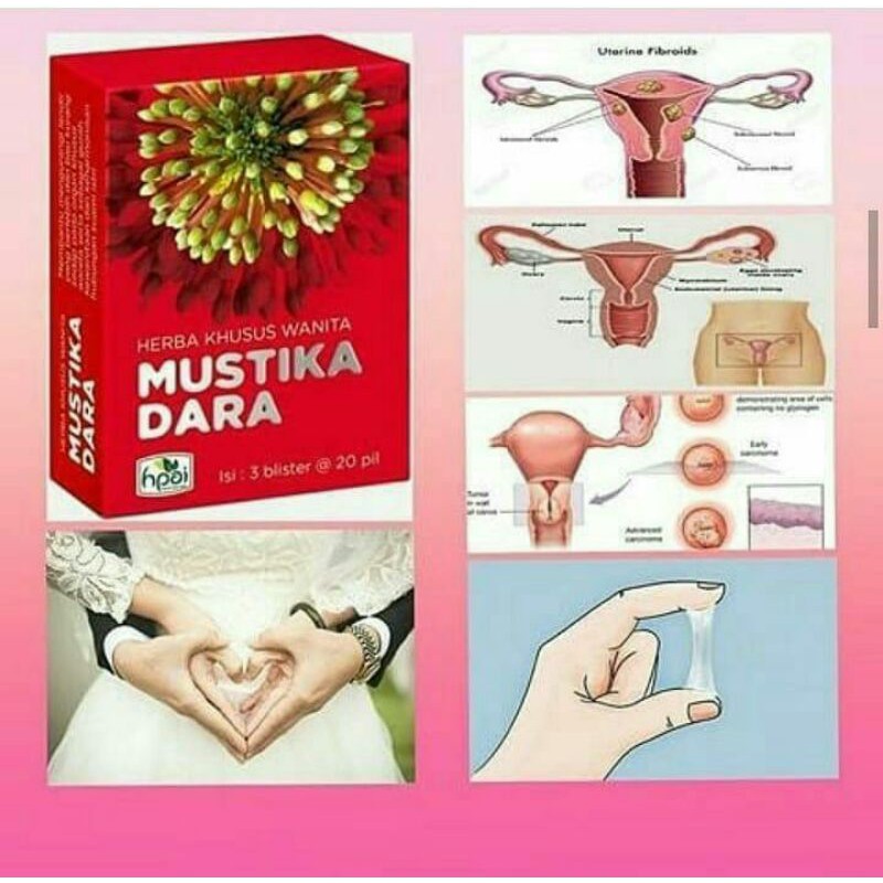 

Mustikadara