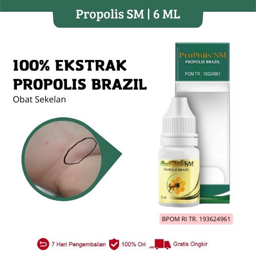 Propolis SM - Obat Sekelan Benjolan Di Selangkangan, Kelenjar Getah Bening, Nyeri Selangkangan, Hern