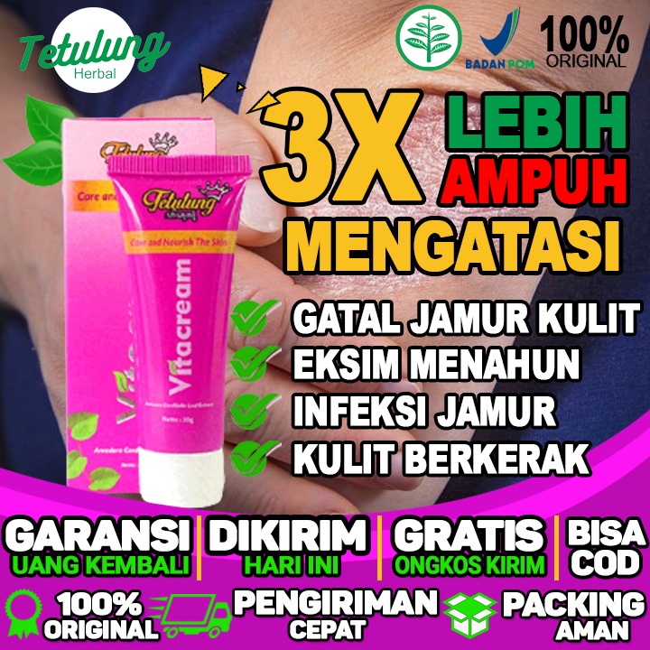 Obat Penyakit Kulit Eksim Panu Jamur Gatal Selangkangan Kudis kurap
