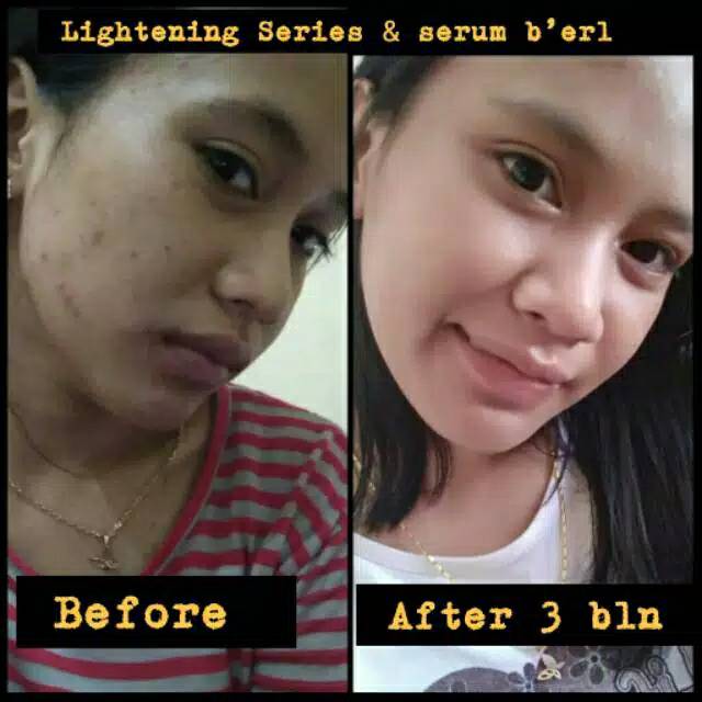 B ERL FACIAL SERUM COSMETICS -ALEXAGROSIR