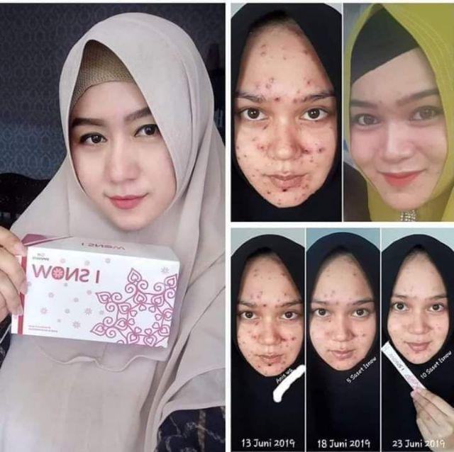 Sprei Polos Emboss Size 120x200, 160x200, 180x200, 200x200