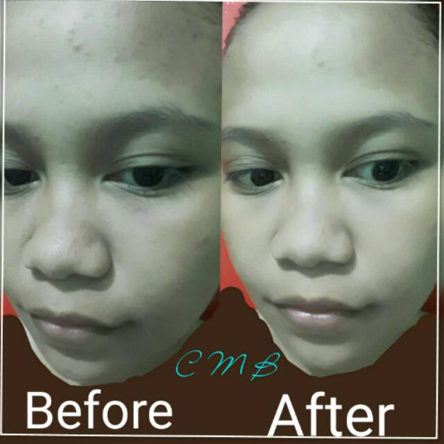

CMBbyRd