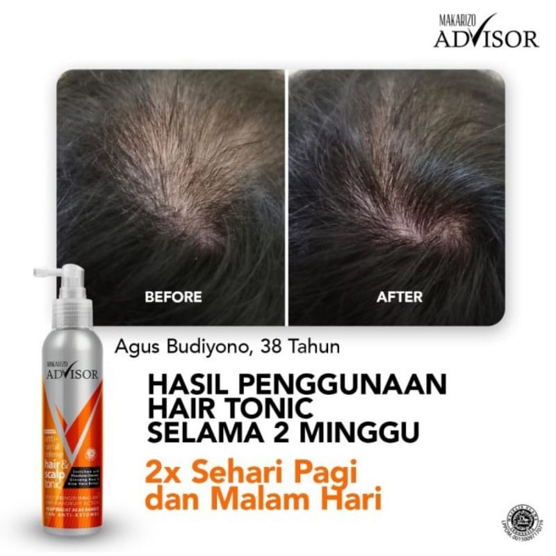 ✿ELYSABETHME✿ 【﻿ＭＡＫＡＲＩＺＯ】 Makarizo advisor hair scalp tonic menutrisi akar rambut anti rontok lepek