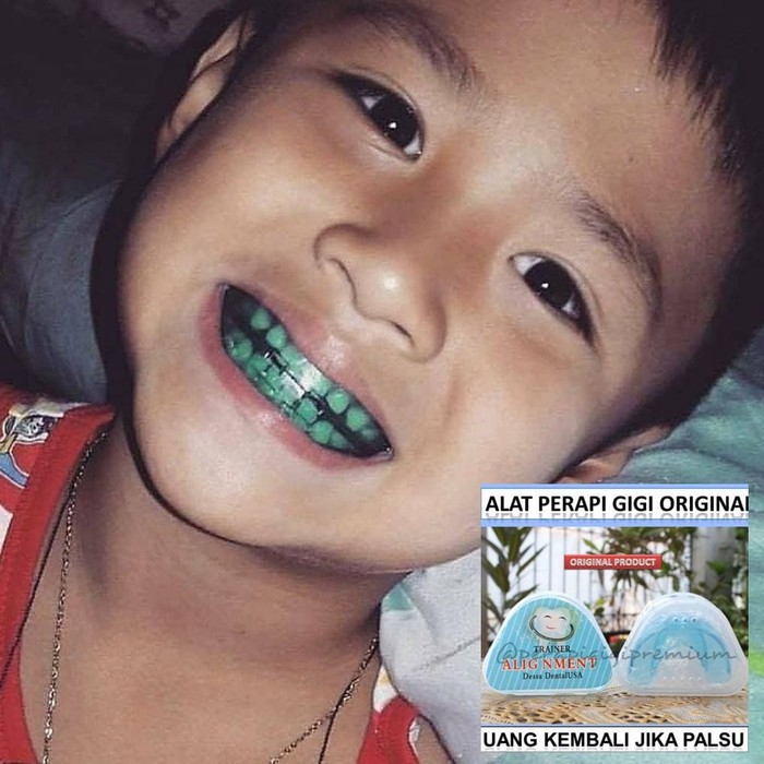 Behel Ajaib Karet Silicon Perapih Gigi Anak Teeth Trainer Tanpa Kawat Gigi