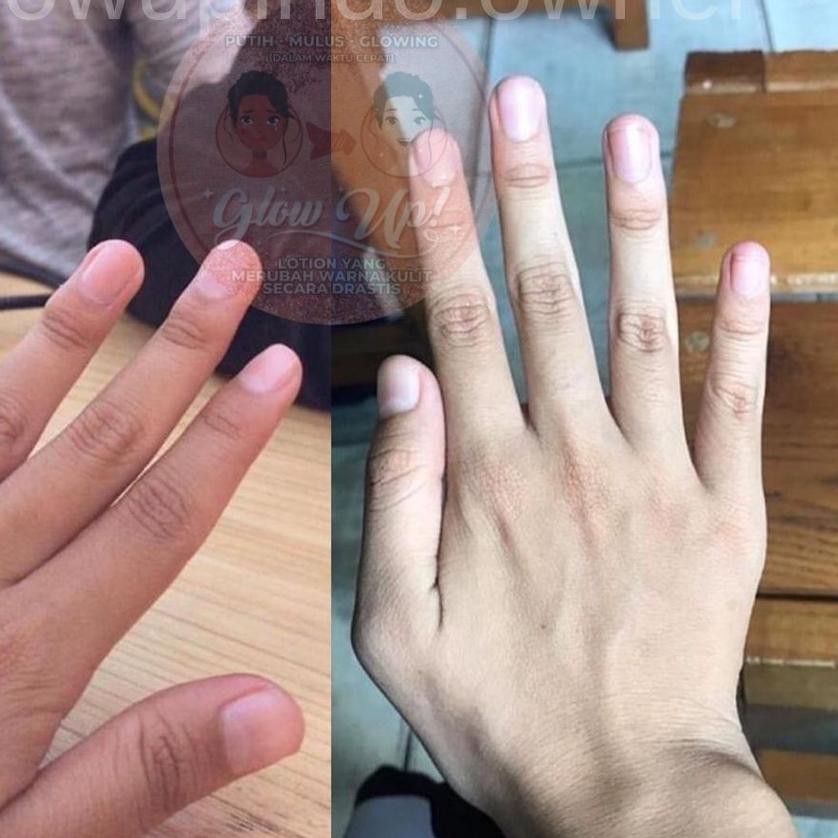 ℗ [HARGA RESELLER] glow up | glowupindo | lotion glow up | FREE MASKER ✰