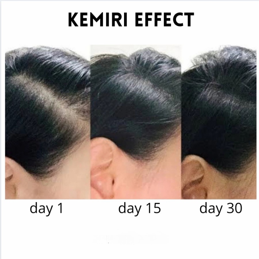 Minyak Kemiri Bali Murni - Solusi Rambut Rontok - Penumbuh Rambut Lebat ( Candlenut Kukui Oil) Alis Jenggot Kumis Bulumata Jambang-1