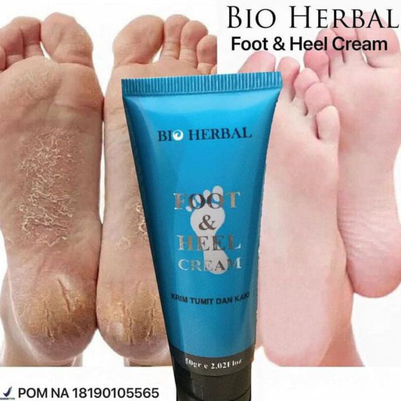 Krim Tumit Obat Kaki Kapalan Pecah Kasar Kering Tumitku Cream Pecah2  Kulit Tangan Bio Herbal