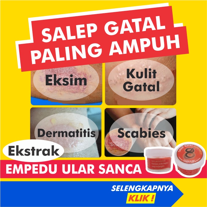 Salep Gatal Paling Ampuh Obat Gatel Saleb Kulit Eksim Kering Exim Basah Menahun Selangkangan Kudis P