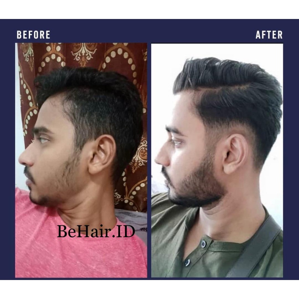 TERLARIS Serum Liquid BIOFINMIX BeHaird.ID BOURN BEARD Finmix Cave Biotin Finasteridee Minoxidil 5% BeHairId Penumbuh Jambang Kumis Alis Rambut Brewok Mencegah Kerontokan Kebotakan Uban ketombe ASLI ORIGINAL 100% Serum Beard OIL Penumbuh Brewok