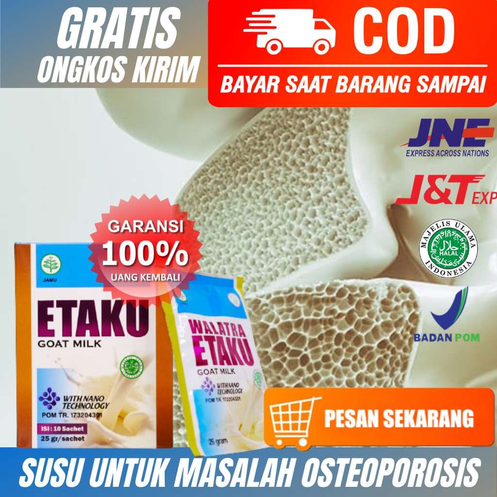 

Susu Untuk Masalah Osteoporosis_Pengapuran Tulang_Tulang Keropos_Kesehatan Tulang_Tinggi Kalsium