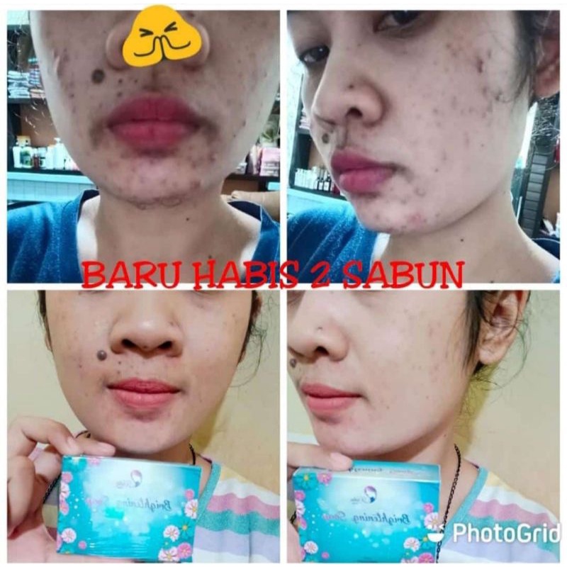 SABUN PEMUTIH VIRAL KEDAS BEAUTY ORIGINAL 100%-1