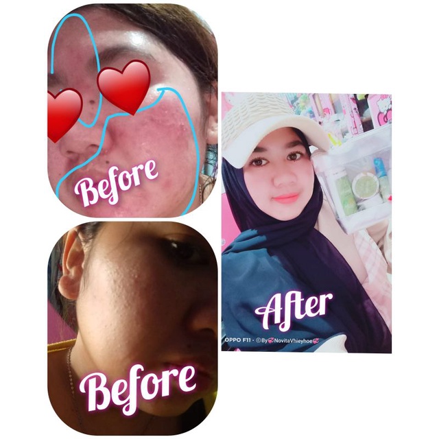 FREE GIFT !!! Haniiskin Skincare 1paket+Serum Premium !! 100% Original.-5
