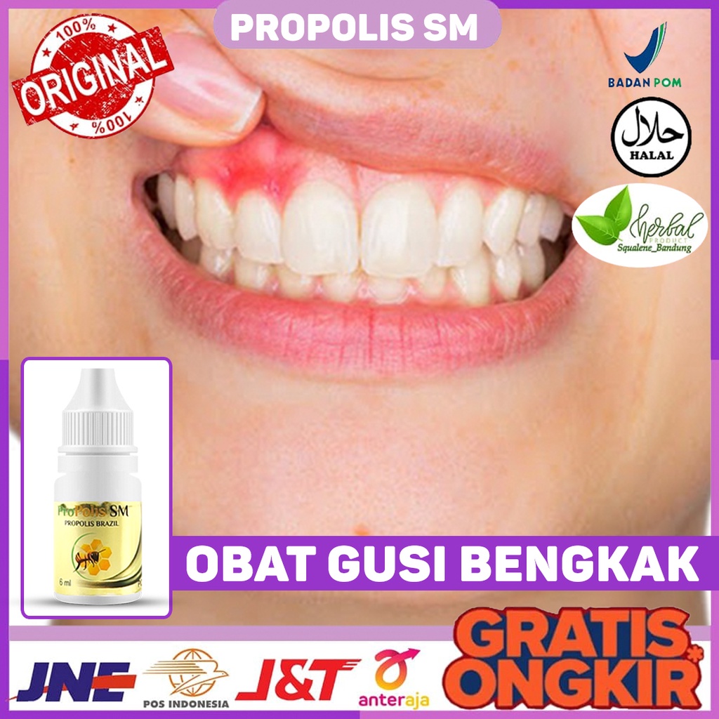 Obat Gusi Bengkak - Obat Gusi Berdarah - Obat Gusi Bernanah - Obat Gusi Bengkak - Obat Gusi Linu - O